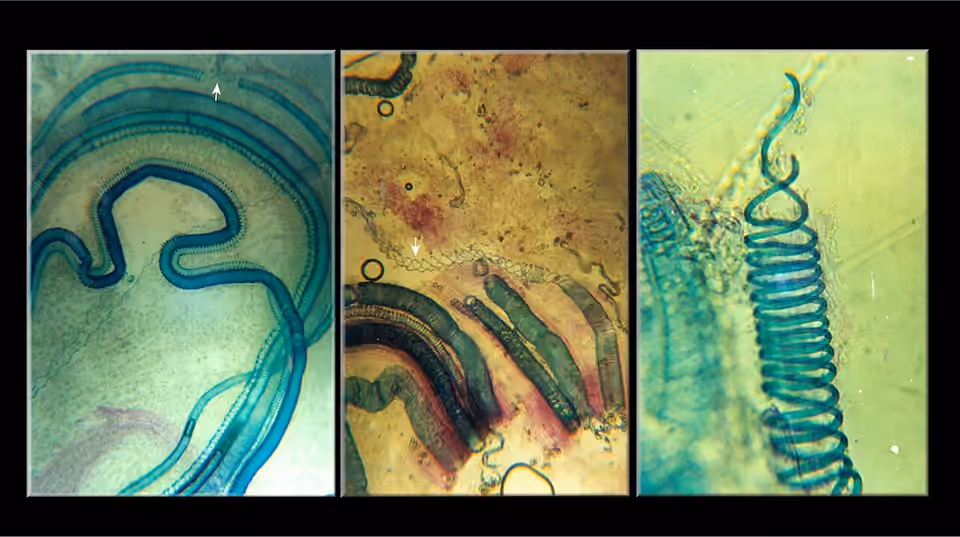 Éléments du xylème d’un figuier observés au microscope.